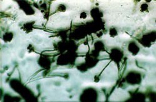 Stachybotrys Mold